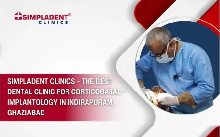 Simpladent Clinics – The Best Dental Clinic for Corticobasal® Implantology in Indirapuram, Ghaziabad