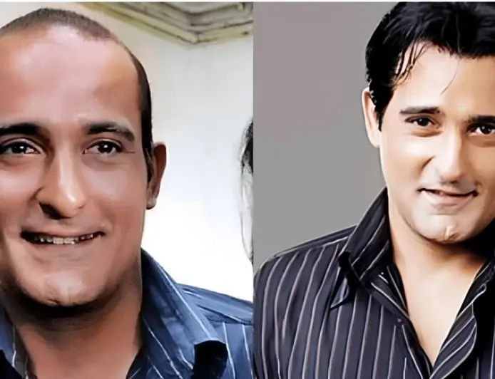 The Secret Behind Bollywood’s Perfect Hair Why Hair Patches Are Becoming the Go-To Solution