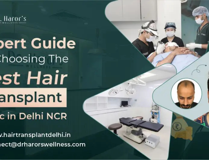 Expert Guide on Choosing the Best Hair Transplant Clinic in Delhi NCR