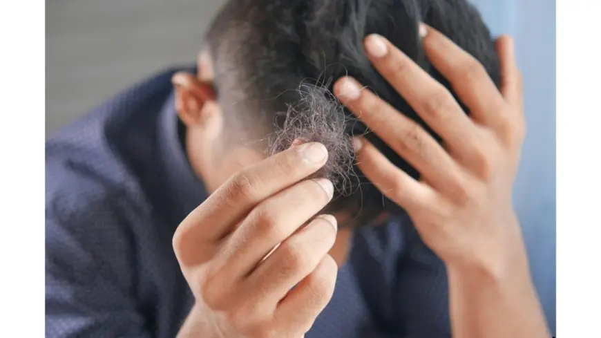 What Are the Main Causes of Hair Fall in Men?